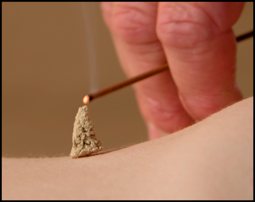 Moxibustion photo